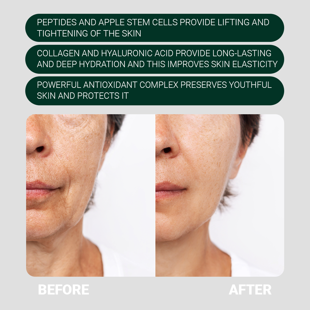 Face Cream with Apple Stem Cells